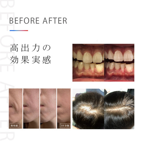 サムネイル5